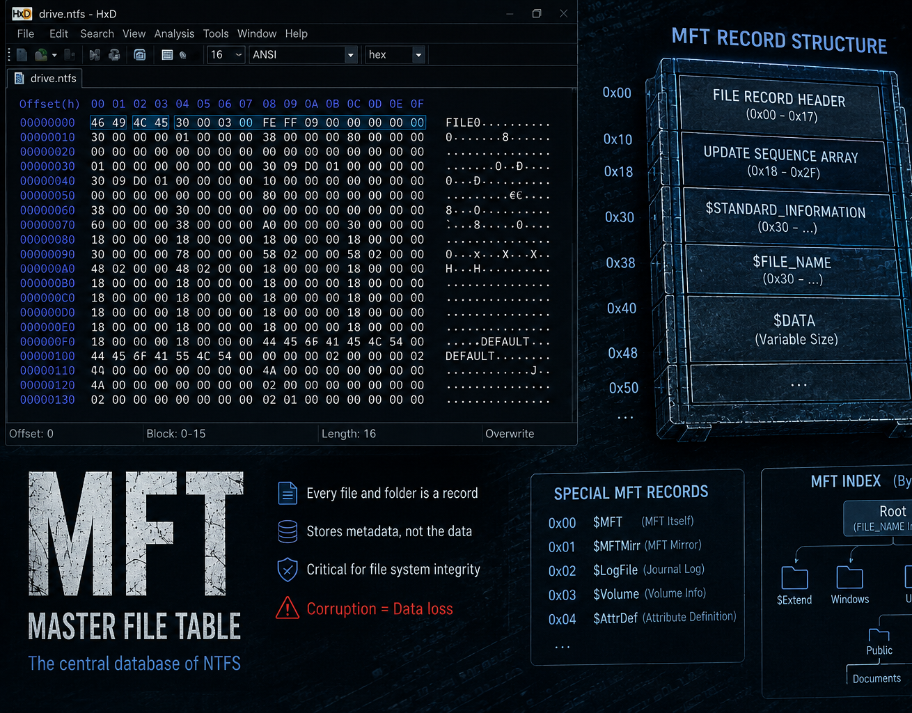 MFT